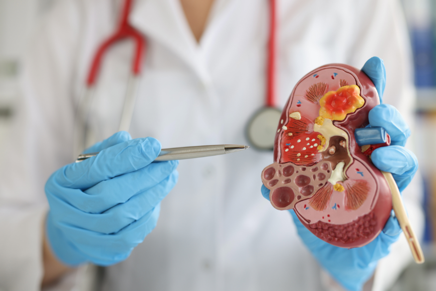 nephrology and dialysis unit
