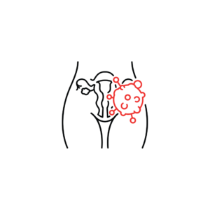Gynaecological Cancers